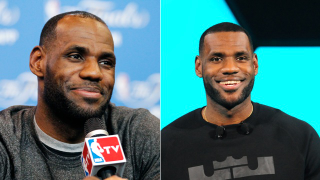 Illustration for article titled Did LeBron James Get Hair Plugs Or What?